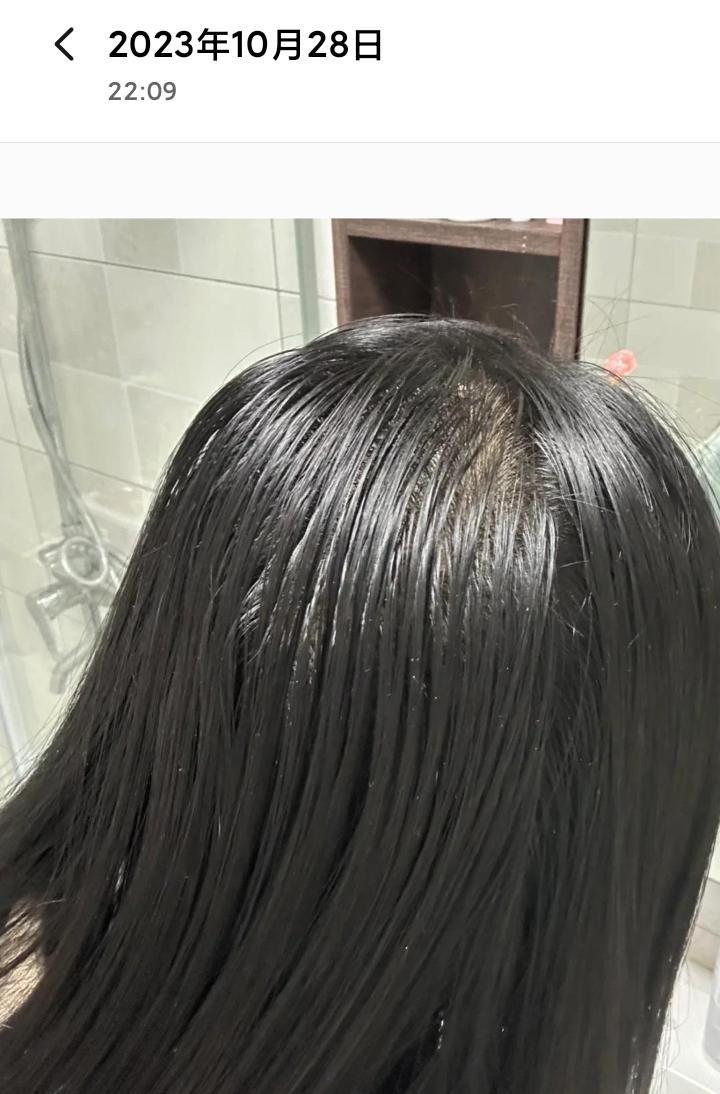 头发为什么爱出油 头发为什么爱出油