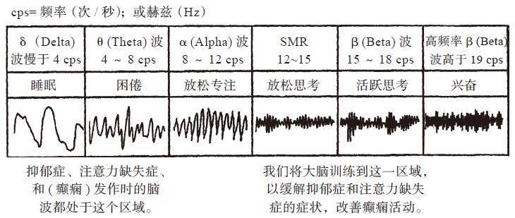 脑波