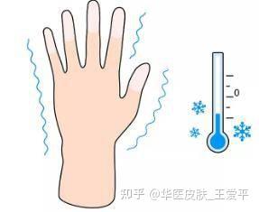皮肤冻伤分等级?看看属于哪个等级? - 知乎