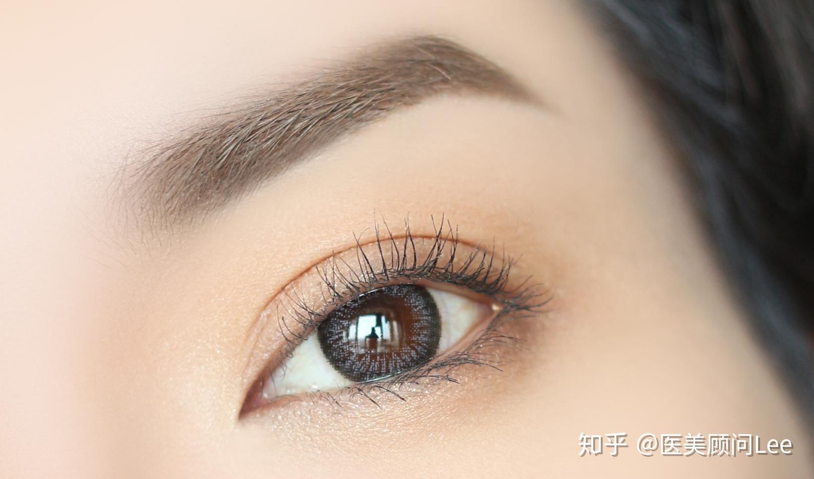 一般来说,割个双眼皮眼睛宽度会增大2~4mm;开个眼角眼睛长度会增大2-4