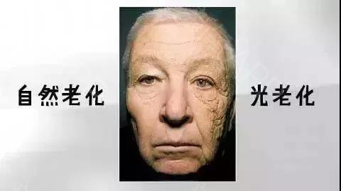 光老化