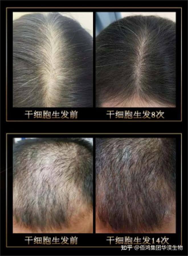 头皮科学？头皮护理进入“细胞级”时代啦！ - 知乎