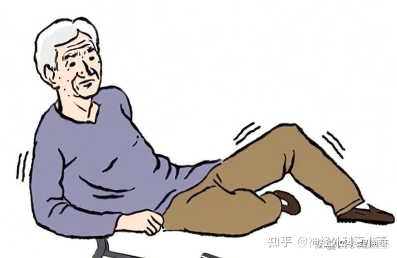 帕金森病脑深部电刺激(DBS)手术:疗效与选择的科学解析 - 知乎
