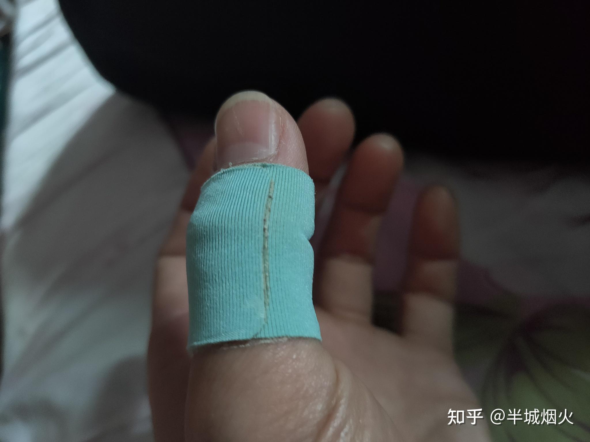 弹吉他时用左手大拇指反扣六弦弹得时间长了左手大拇指发麻怎么回事?