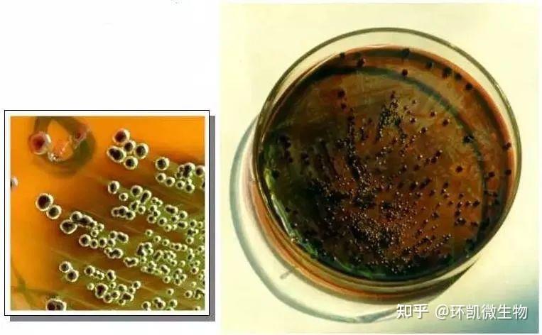大肠菌群、粪大肠、大肠埃希氏菌检验的相关知识 - 知乎