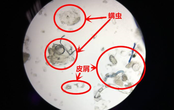 床上螨虫排泄物图片图片