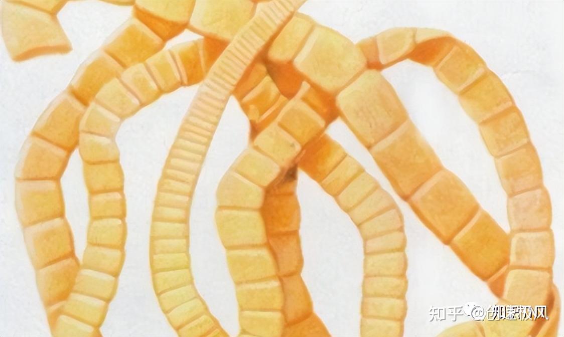 绦虫到底有多长?如何避免? - 知乎