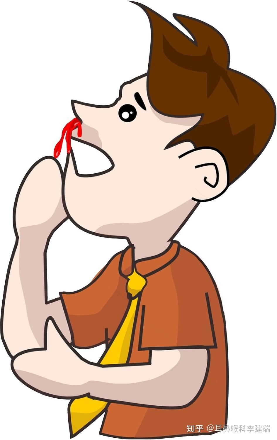 鼻出血的正确止血方法你学会了吗