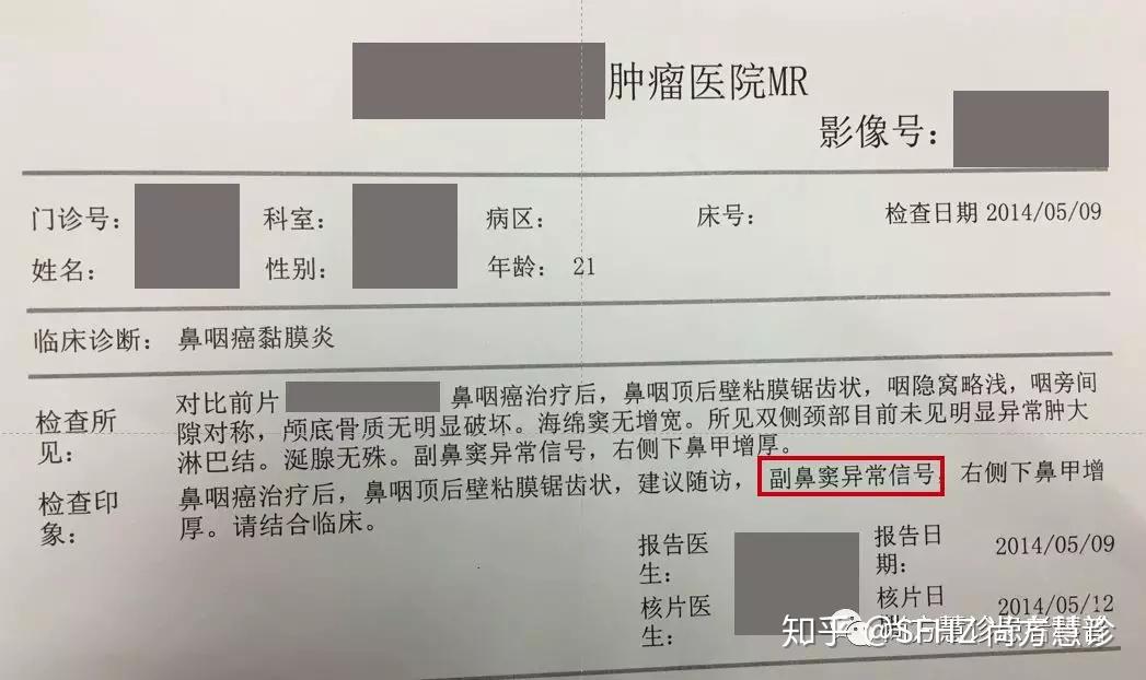 从21岁鼻咽癌复发患者赴日本再程放疗后已痊愈近4年解析复发诊疗的