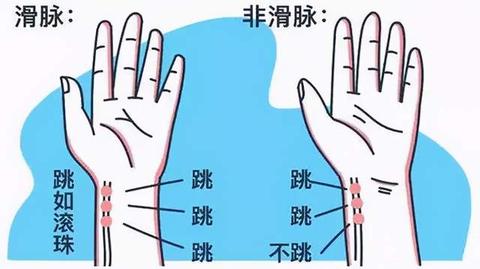 然后突然下跪大呼:"恭喜娘娘,贺喜娘娘,您这是喜脉啊!".