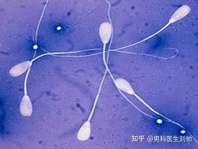 v2-792f0848cc6690972fafb6a2bbf7d58a_b.jpg