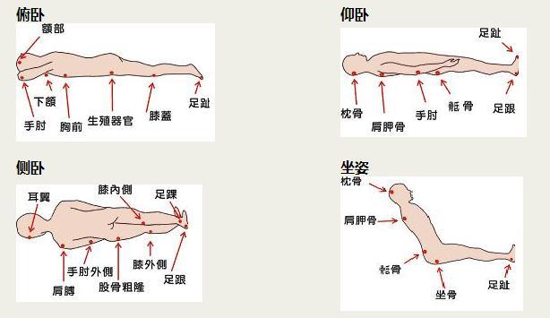 8% 但如果进行压疮风险评估及采取积极有效的预防护理措施