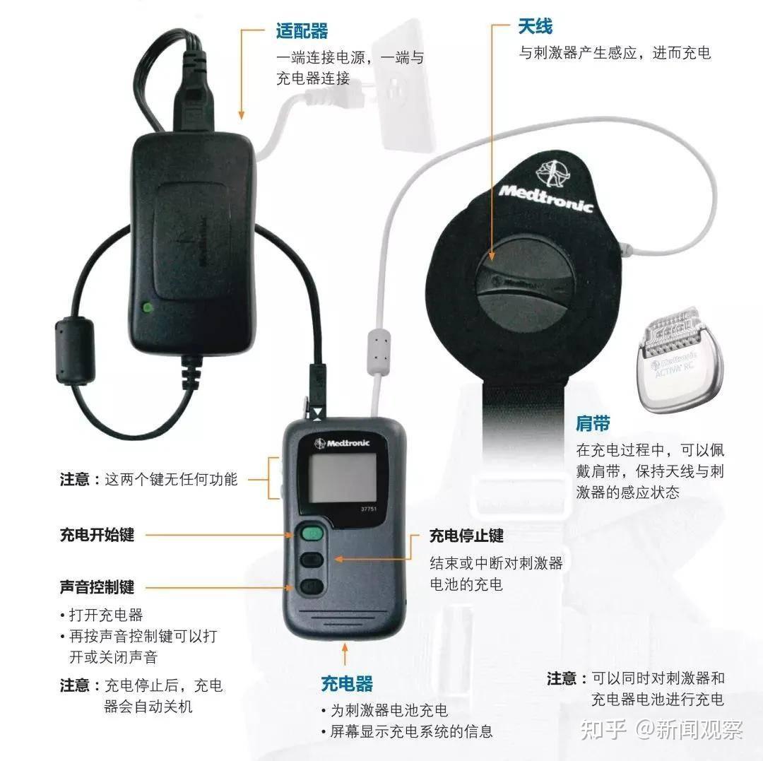 【务必收藏】进口美敦力Activa RC脑起搏器充电器操作教程 - 知乎