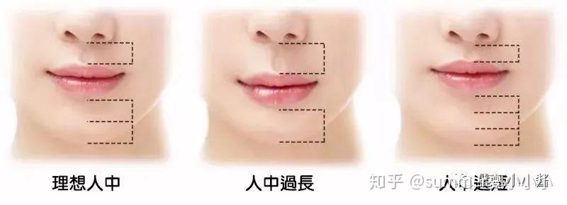 详解:人中沟是如何增加或者拖累颜值的|日本医美 - 知乎