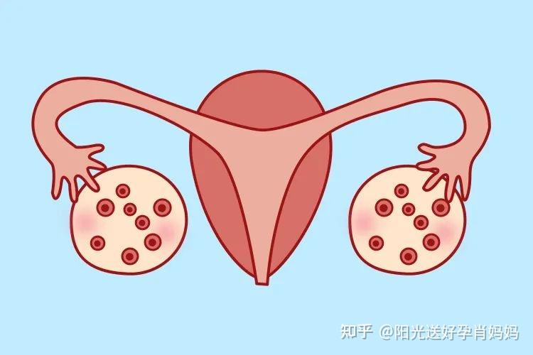 易孕体质的6大特点,你有几个? - 知乎