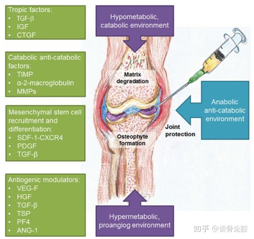 膝关节腔内注射图解图片