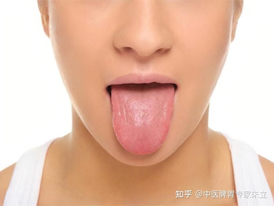 正常舌头颜色一般是淡红色,浅粉红色