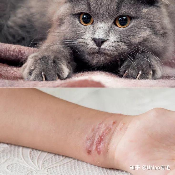 第101次被猫抓伤后,我终于知道该怎么做了!! - 知乎