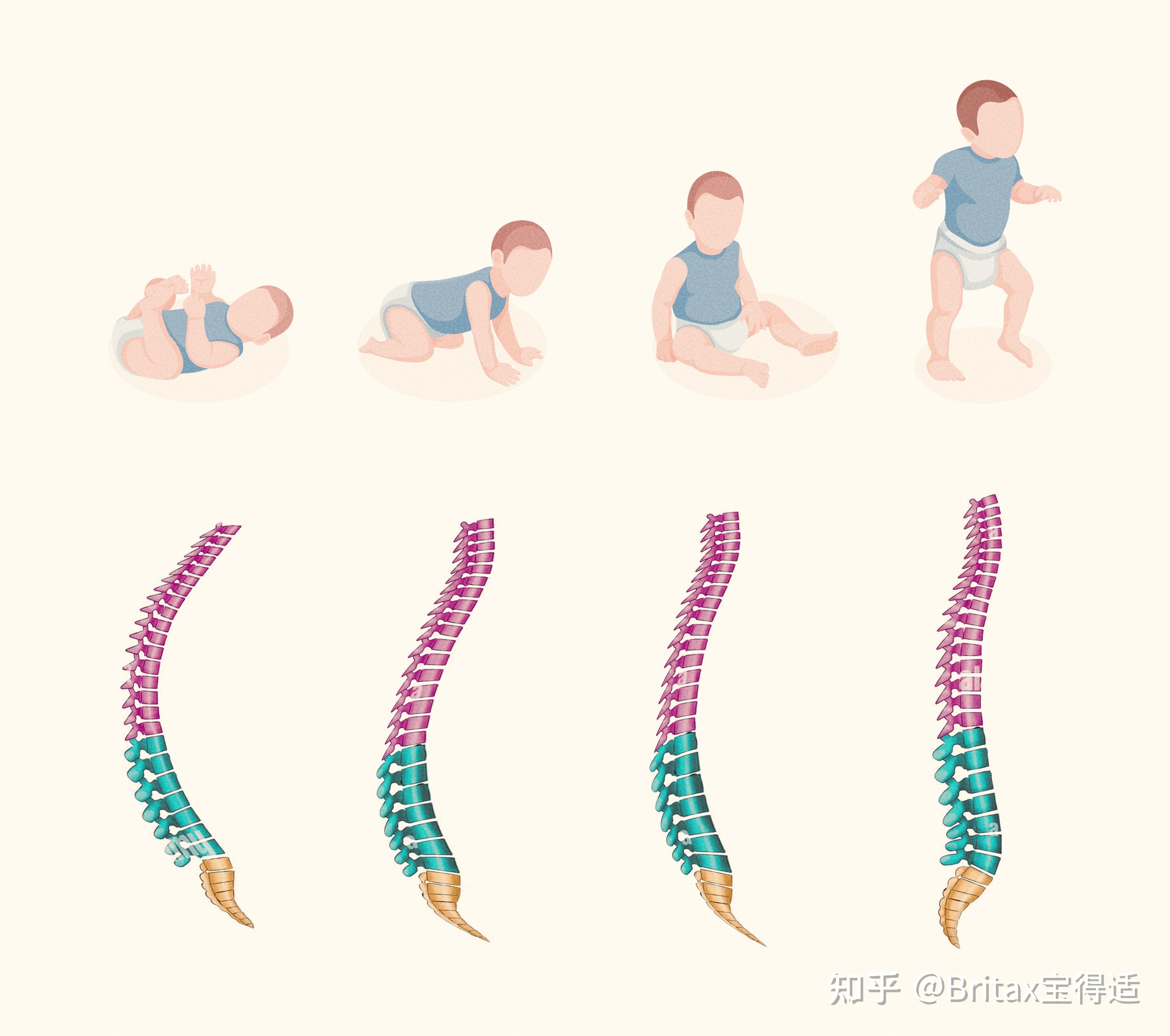 9岁女孩侧弯18度，训练五个月后，脊柱基本回直 - 知乎