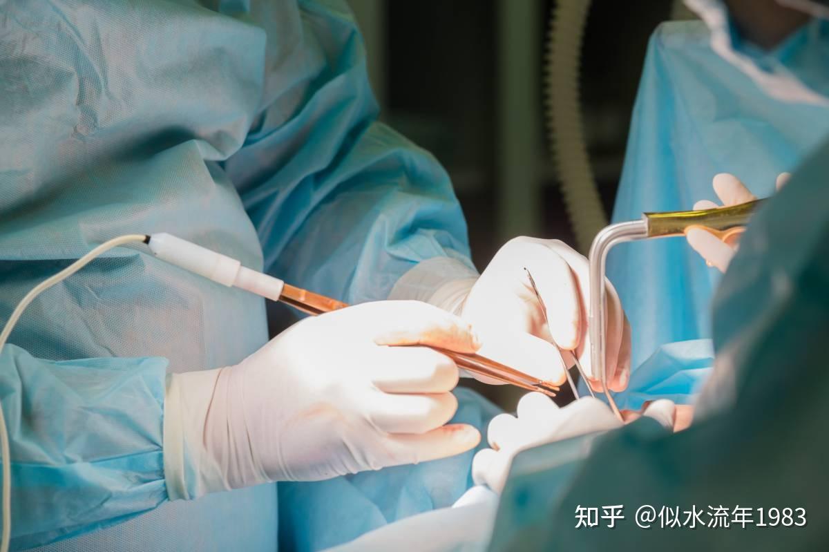 插了T管引流,该注意点啥 - 知乎