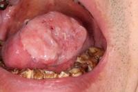 【槟榔芋是由槟榔制成的嘛...】 - 知乎