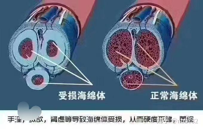 v2-79a4da58a6fd3f7f08fe9d8bc88ce5ba_r.jpg