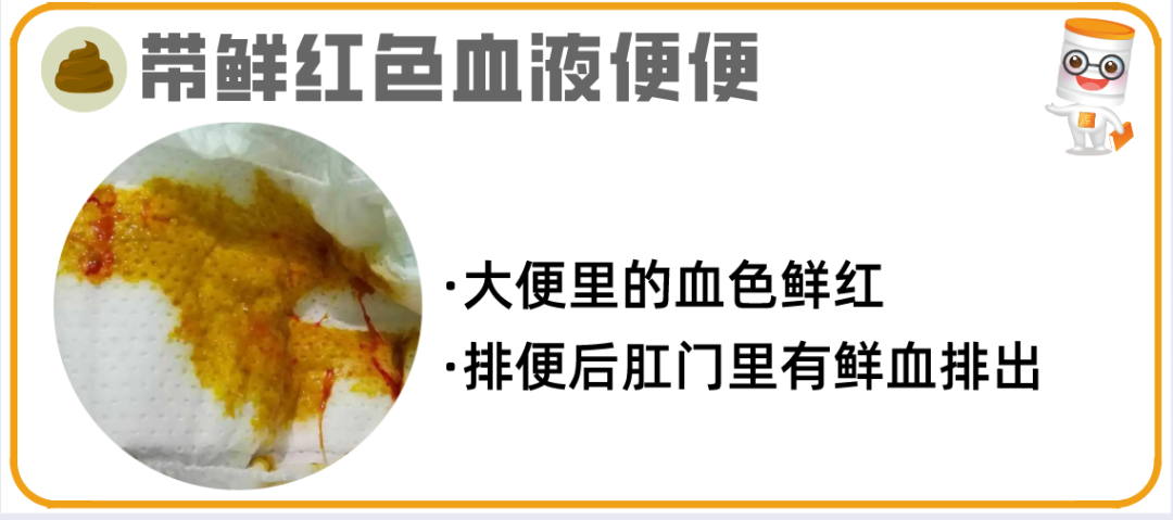 逾20种宝宝大便图片详解!最后10种必须警惕! - 知乎