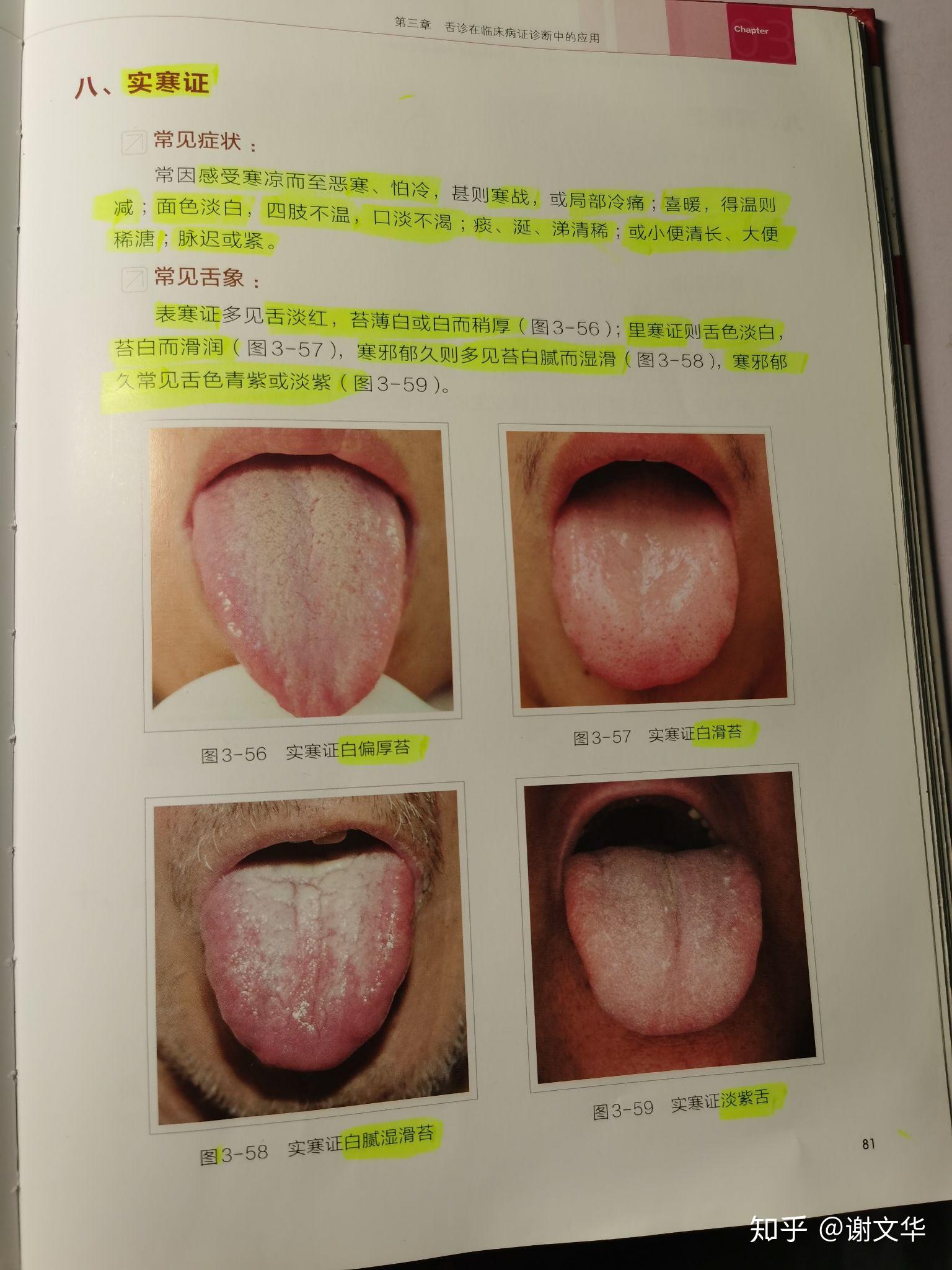 色青紫或淡紫表寒证多见舌淡红,苔薄白或白而稍厚;常见舌象:脉迟或紧