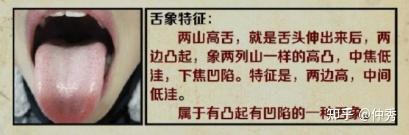 中医舌诊详解大全(独家讲义) - 知乎