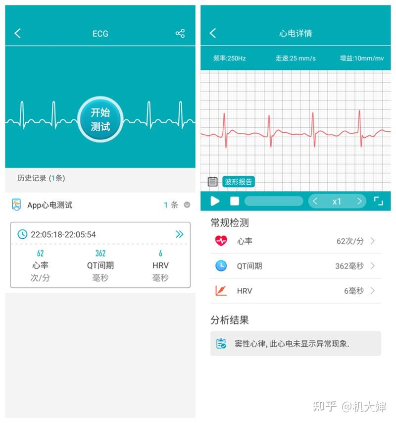 通过智能app,通过打开"h band",可以看到历次的心电数据,而且还带有