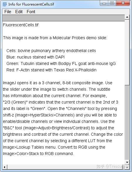 ImageJ实用技巧——重新认识你的图像(基本功能篇) ImageJ实用技巧——重新认识你的图像(基本功能篇)