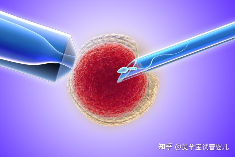 关于试管婴儿是用什么技术的俗称的信息-第1张图片-鲸幼网