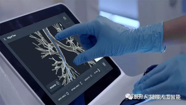 直觉外科手术公司intuitivesurgical发布了ion机器人肺活检系统