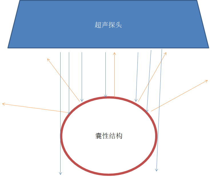 超声的侧壁失落效应
