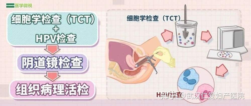 武漢婦產醫院_宮頸癌,hpv,tct三者有什麼關係? - 知乎