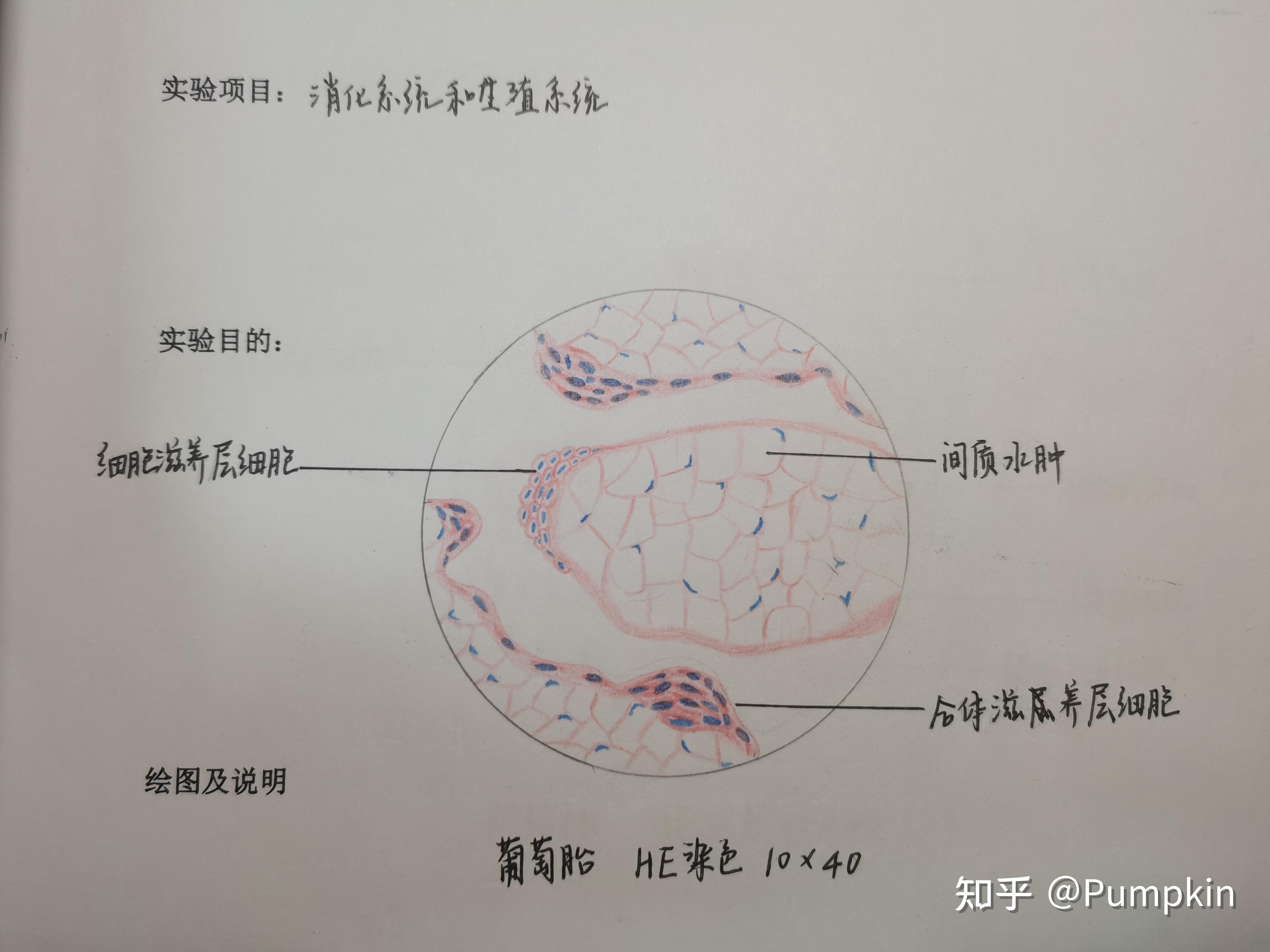 葡萄胎绘图图片