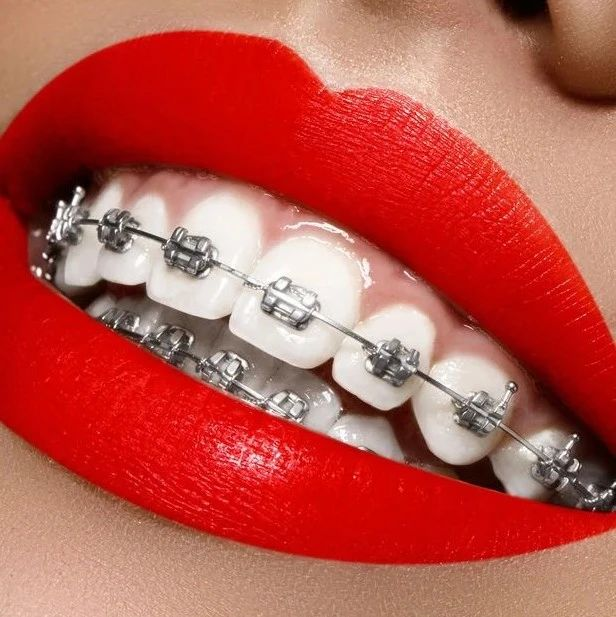 v2-7c4b33f83bb252eef7caa72fbf2cebda_1440w.jpg?source=172ae18b