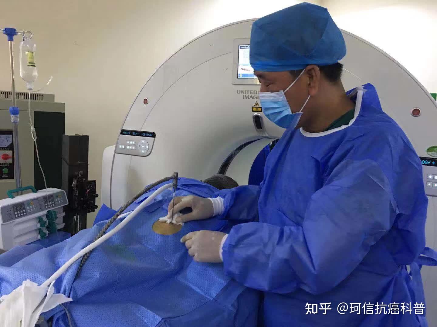 结肠癌克星——康博刀复合冷热消融 - 知乎