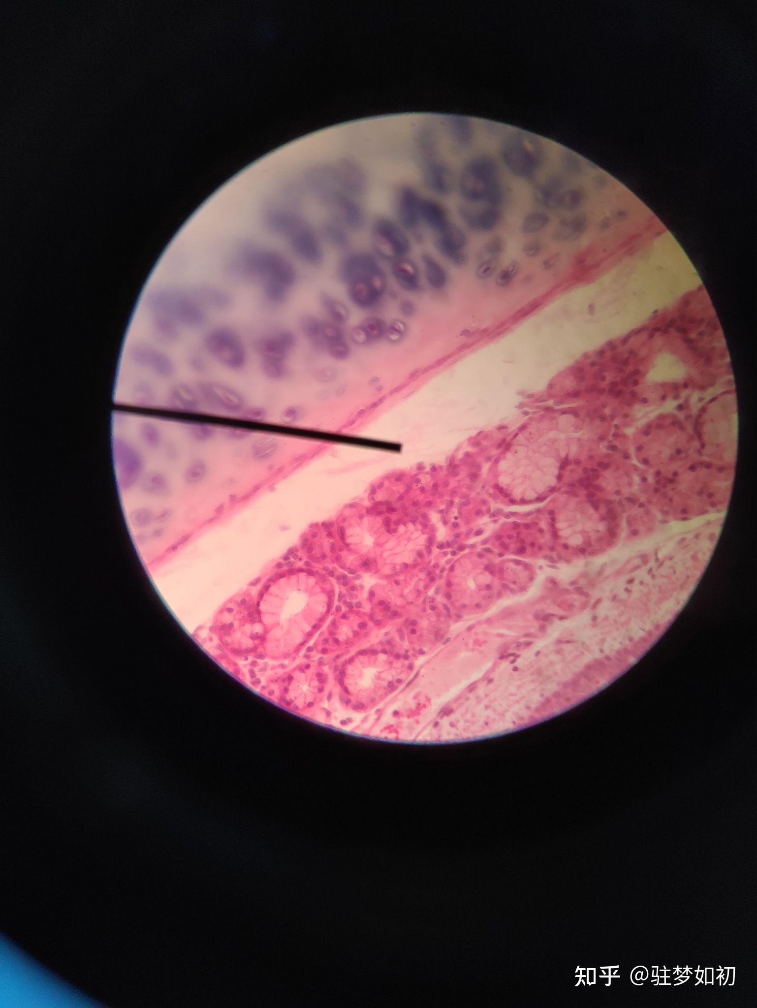 气管肾上腺心肌睾丸卵巢