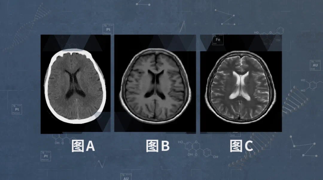 一文带您读懂CT和核磁共振中的“癌信号” - 知乎