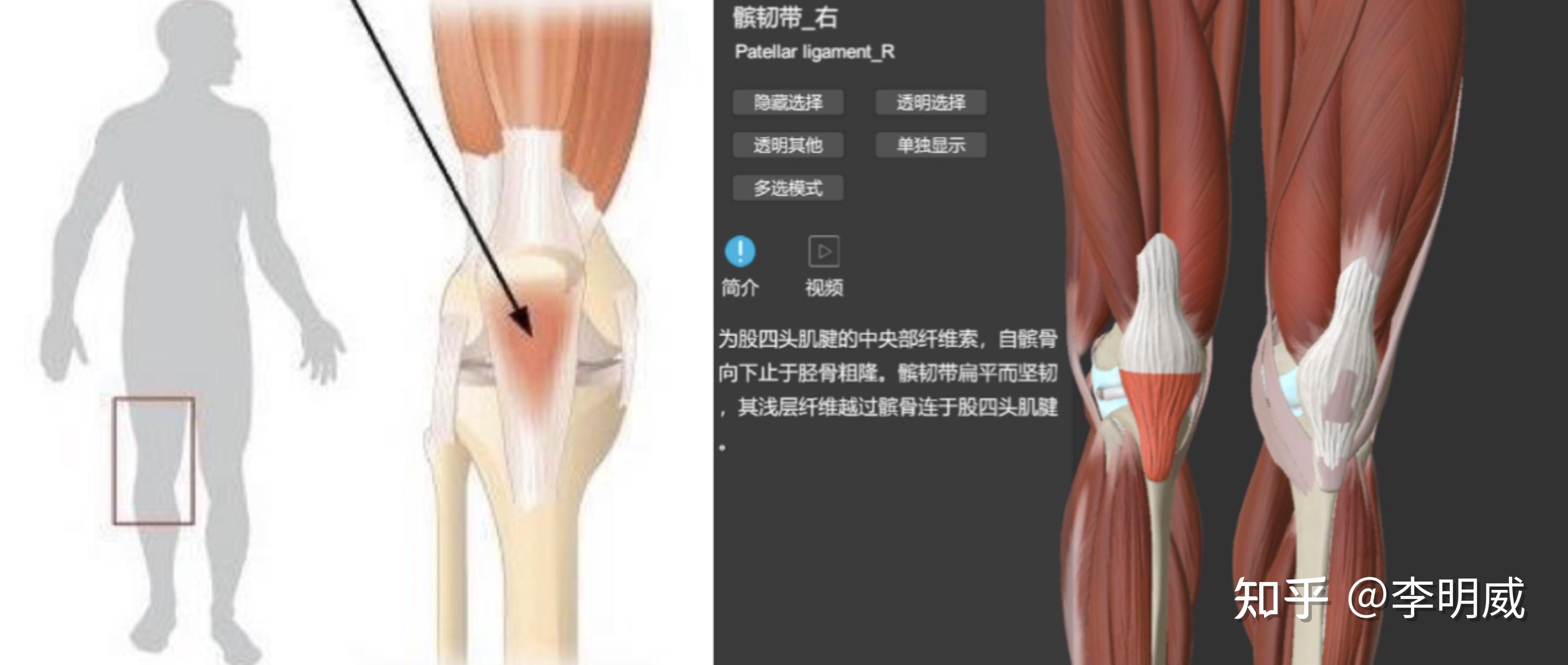 李明威:膝盖下方位置疼痛,是什么原因?应该如何解决?