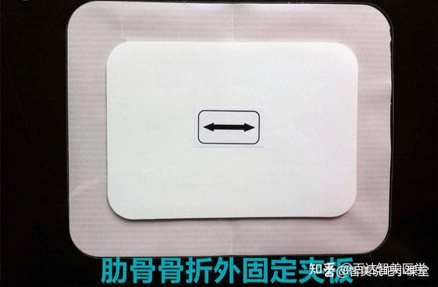 新品肋骨固定板【又名胸骨固定板】有哪些性能升级?