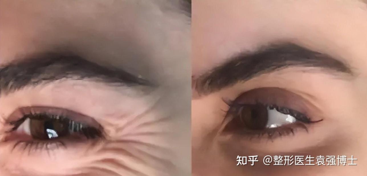 将白人纹成黑人电影叫什么