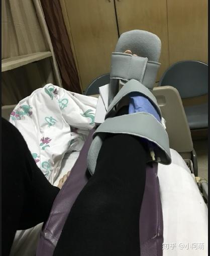 人生中第一次手术脚踝腓骨骨折手术