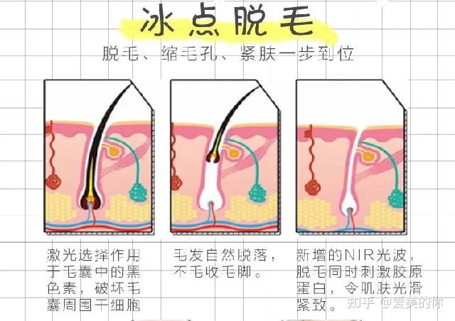 一般來說父母的毛髮越是旺盛,所生出的孩子毛髮也會相對旺盛;除此便是