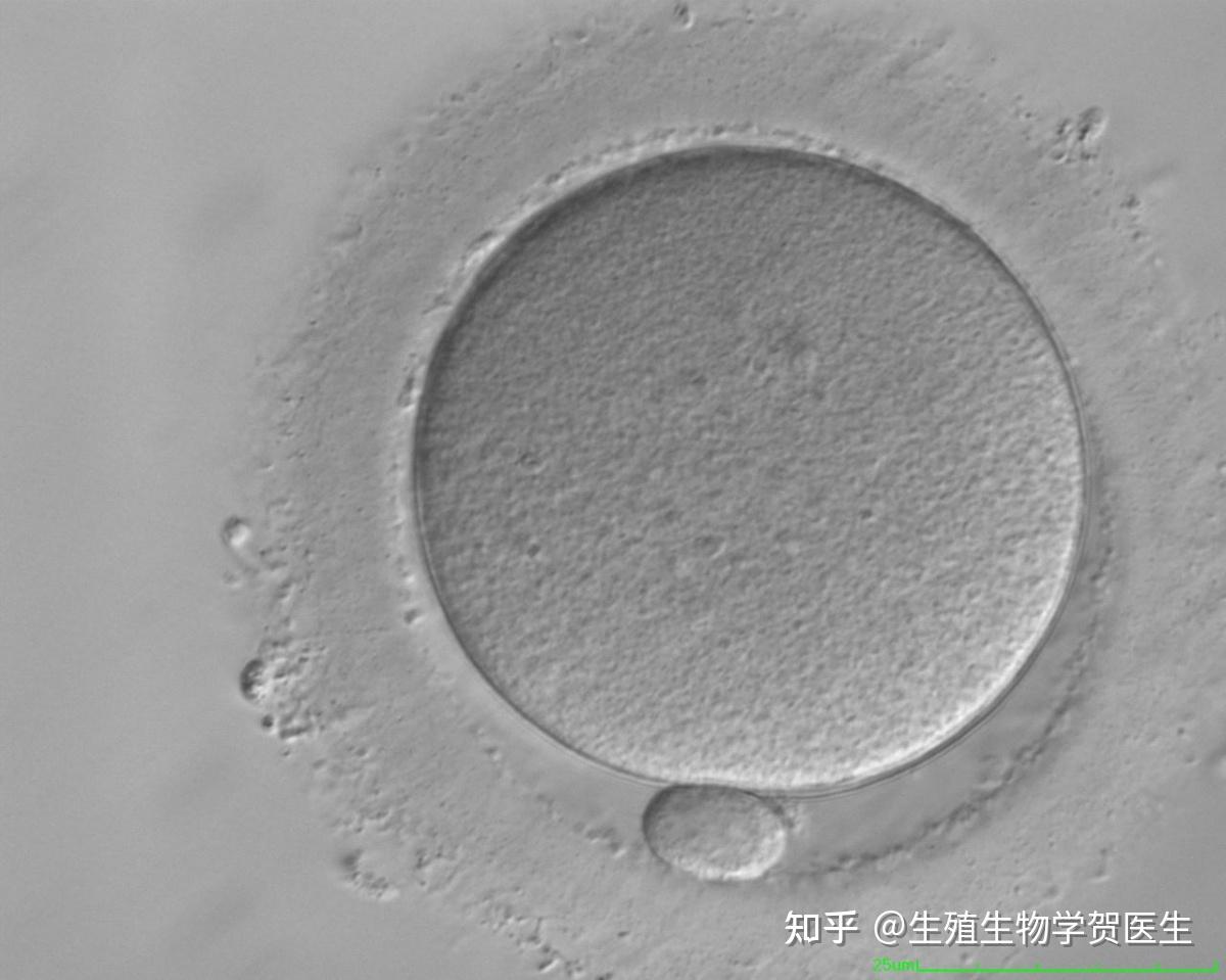 把卵子放大400倍可以发现哪些异常