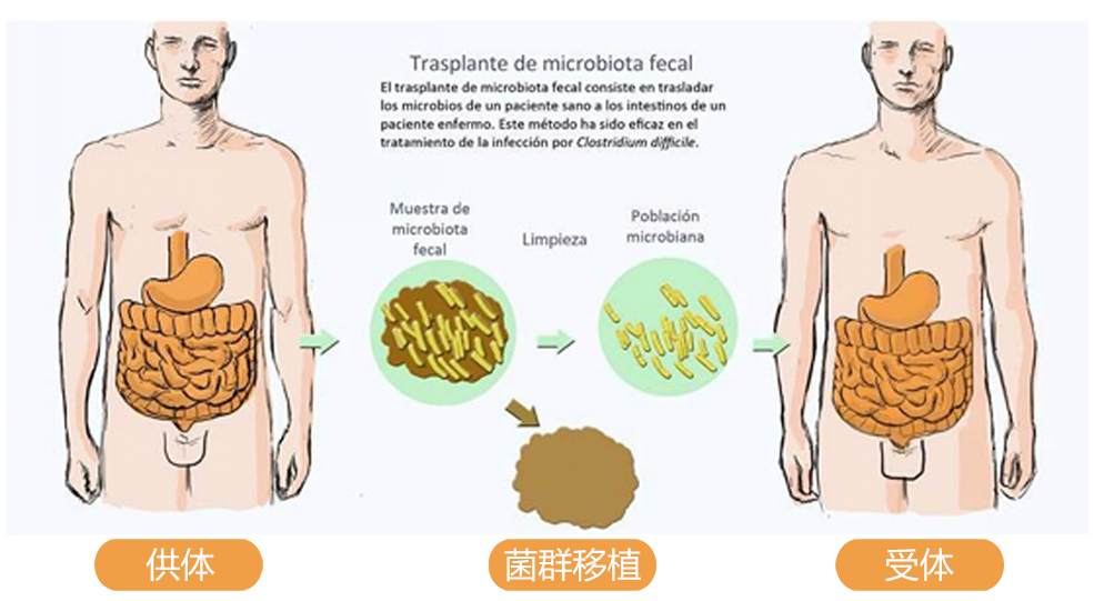 震惊新冠患者接受菌群移植2天后痊愈症状全消失