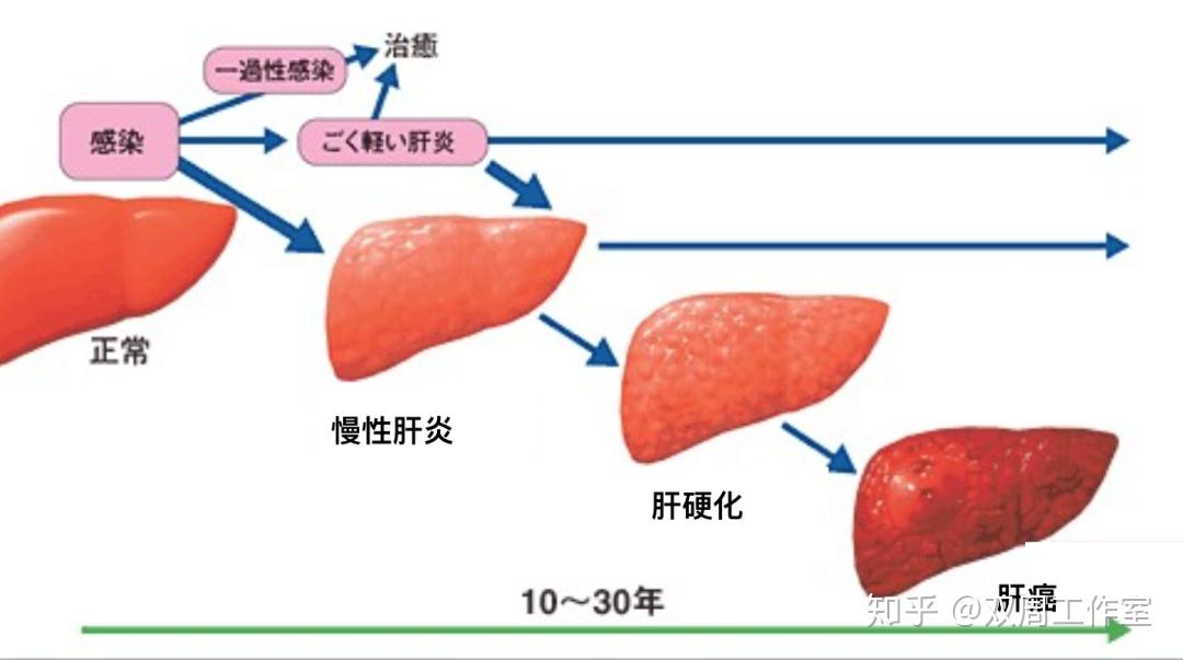 世界肝炎日i三分钟教你读懂乙肝两对半