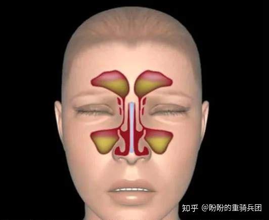 只知道鼻窦炎的可怕?可知道鼻窦的作用 - 知乎