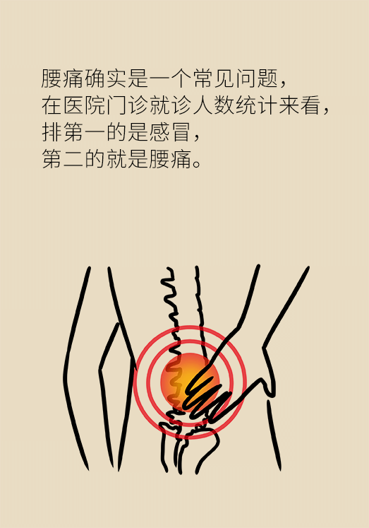 协和医院流出的最实用腰痛自查攻略看完就知道自己用不用去医院